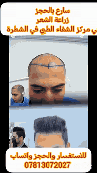 زراعة شعر • مركز الشفاء • الشطرة