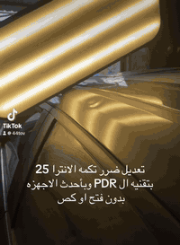 تعديل ضرر تكمه الانترا 25 بارد بتقنيه ال PDR وبأحدث الاجهزه الحديثه بدون فتح او كص سمكره ابو صباح  لكافه أنواع السيارات الحديثه تعديل وتبديل الاجزاء المتضرره  تعديل حار و بارد باحدث التقنيات وباحدث الطرق والاجهزه  الحديثه PDR وGPR  تعديل أضرار الحالوب بغداد الشيخ عمر قرب محطه الكعبي 
 *********** 
***********
