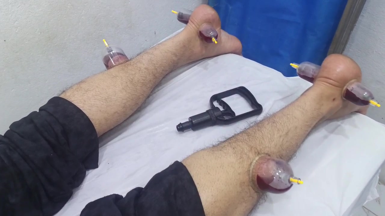 عيادة الرحمة للحجامة الوقائية والعلاجية... السماوة حي الجمهوري 
درجة تعقيم عالية وأدوات استعمال مرة واحدة وإرشادات صحية وطبية وقياس الضغط والسكر ومعالجة حالات ارتفاع الضغط وارتفاع نسبة الدم وارتفاع الكولسترول والدهون الثلاثية والصداع النصفي وعرق النسا ومعالجة حالات السرة... للحجز والاتصال *********** مجاور مكتب حمدي للحاسبات