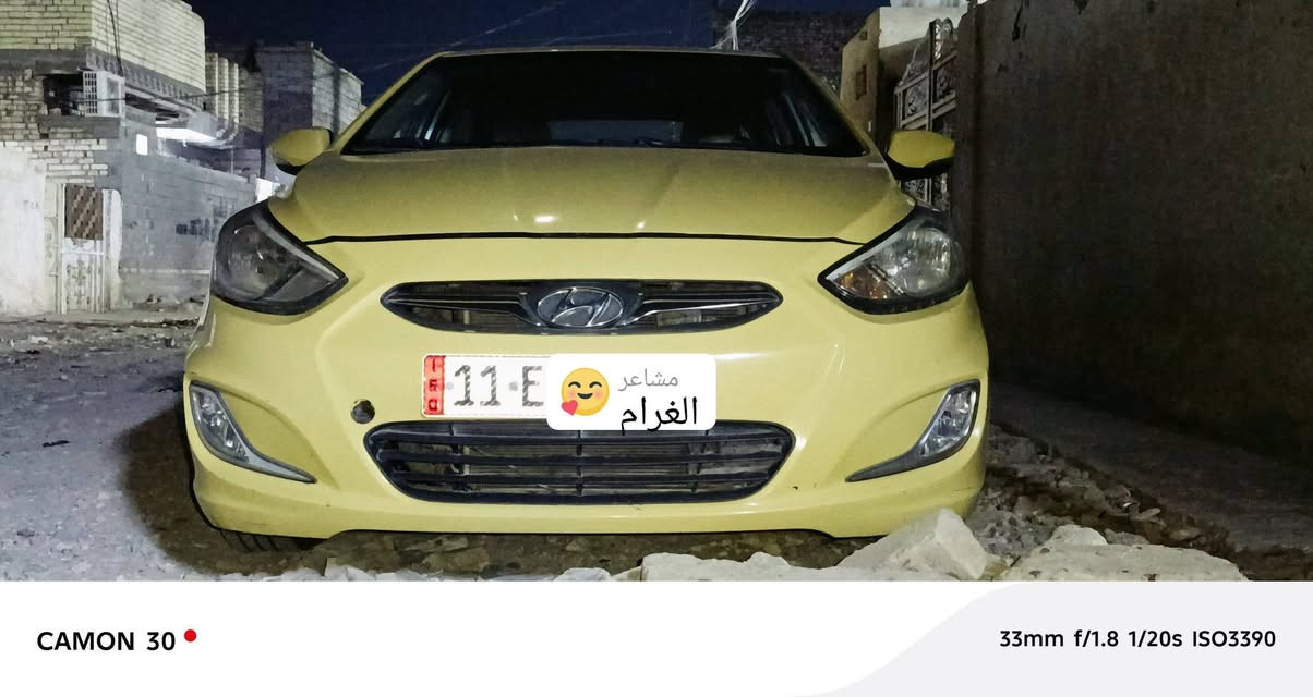 السلام عليكم ساره اكسنت 2015وارد خليجي الساره خير من الله تبيد تفهة رقم نكليزي سنويه السنت 2030 بسمي تحويل ثانيوم ساره جاهزه العمل بكاني بغداد حي البتول الشراي يتصل عل رقم السعر 90وبيه مجال بصيط ساره كفاله عامه***********
