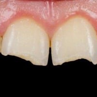 الي عنده هيج حالة يتواصل وياي 07735283842