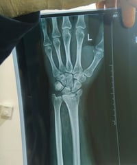 وبركاته   شاب صغير بالعمر سوا حادث وصاحب الدراجه انهزم عملية ب 500 شي ...