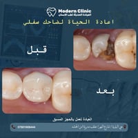 ارجاع السن • العيادة الحديثة • كربلاء حي البلدية