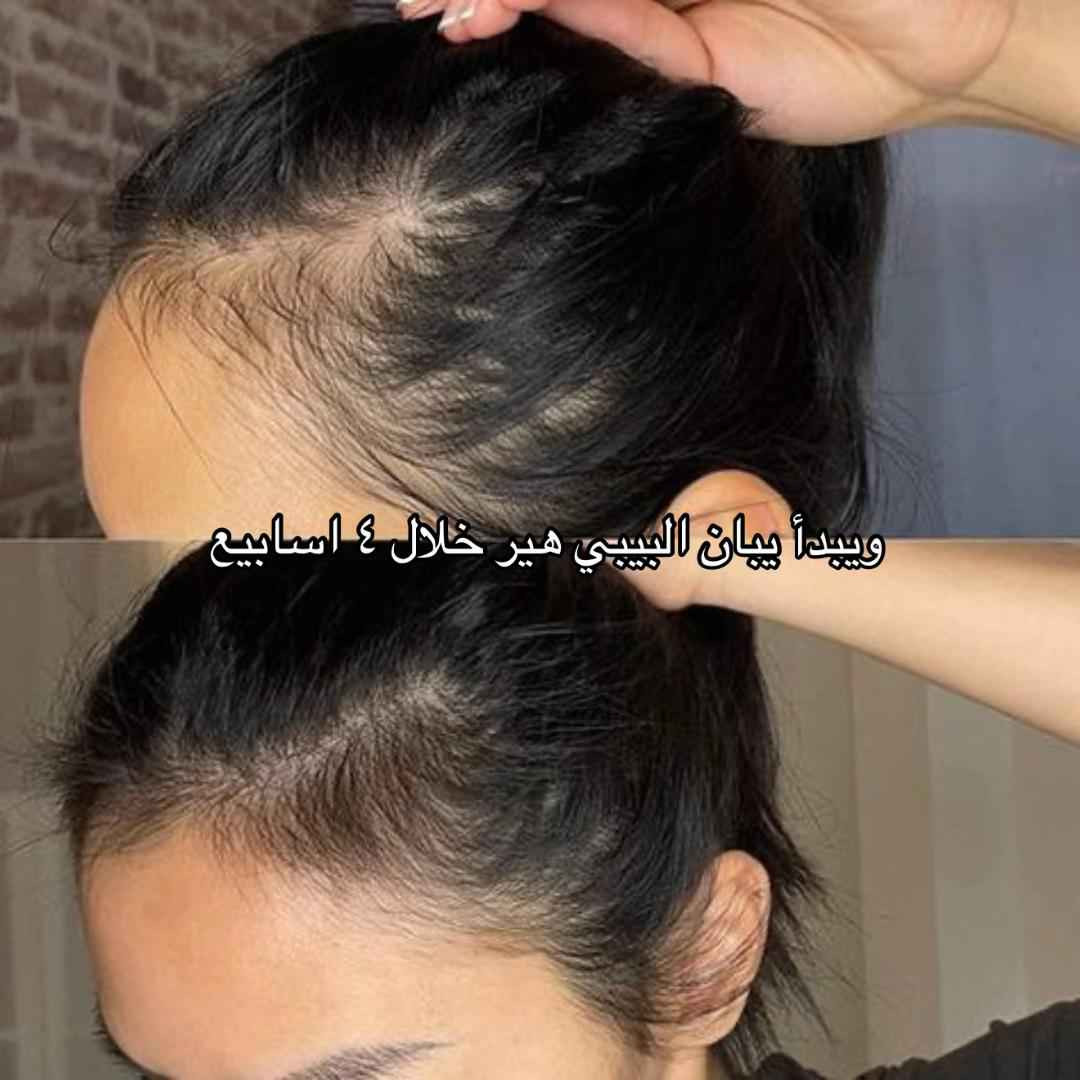 صابونة سيفن جرين (Seven Green Shampoo Bar):
الوصف: قالب شامبو صلب مصنوع من خلاصة الأعشاب الصينية التقليدية مثل Cacumen Biotae وIsatis Indigotica.
الفوائد: تنظيف فروة الرأس بعمق وإزالة الدهون والقشرة، تقوية بصيلات الشعر، والمساعدة في تكثيف الشعر كبديل طبيعي لزراعة الشعر.
المميزات: خالية من الكبريتات والسيليكون والمواد الكيميائية الضارة دهل اوران, واسط


**إذا كنت صاحب هذا الإعلان وتريد حذفه لأي سبب، رجاءا أرسل رسالة إلى الدعم الفني**