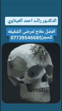 افضل علاج لمرضى الشقيقه هو حقن البوتكس مع الدكتور رائد احمد العيثاوي  ...