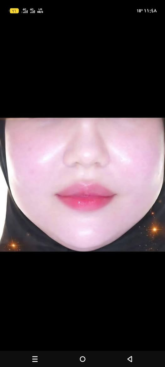 خلطات طبيعيه مكونه من الفيتامينات   مضموونه ومجربه100%💯 طبعا جميع الخلطات وفرتهم على طلب الزبائن  🌹 والاصلي   🌹لتبيض الوجه خلطة بالفتامين  .. اعطاء نظارة واشراقه بياض دائمي وليس وقتي🌹  🌹لازالة التصبغات والكلف الناتجه عن الحراره او عن اشياء اخرى🌹تنعيم وتبيض ما في اي خشونه 😍انوثه  المنتج للوجه / والرقبه نتائج من اول اسبوع  1-تبيض الوجه  2-توحيد لون البشر 3-تستخدم لحبوب الشباب  4-تستخدم لمعالجه الكلف  5-تعطي نظاره وحيويهً ل وجه  6-تعالج خطوط التجاعيد الضاهرهً في الوجه  7-تستخدم ل معالجه وتقليل النمشً  الوجه في علبه واحده فقط   تتوفر خدمه توصيل لجميع محافضات العراق


**إذا كنت صاحب هذا الإعلان وتريد حذفه لأي سبب، رجاءا أرسل رسالة إلى الدعم الفني**