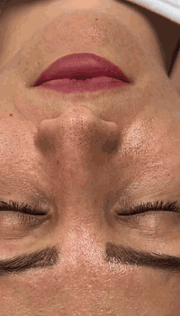 جلسه تنضيف بشره هيدروفيشيال 🤍🔥
فوائد تنضيف البشره :

✅-إعادة النضارة للبشرة الباهتة وتحسين ملمس البشرة.
✅-تقليل إفراز الزيوت في البشرة الدهنية 
✅-تخليص البشرة من الرؤوس السوداء والبيضاء.
✅-تحفيز الكولاجين الذي يعطي نتائج فورية.

العنوان الخاجيه شارع 40 داخل السوق لعصري 🌲 حبايبي اسم مالتنه نونه اكرلك ماعدنه غير فرع
***********
