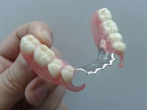 السلام عليكم
تقدم عيادات جامعة الصفوه خدماتها المجانيه
قلع اسنان تالفه وجذور وتعويض ب طقم متحرك 
للتواصل ***********
