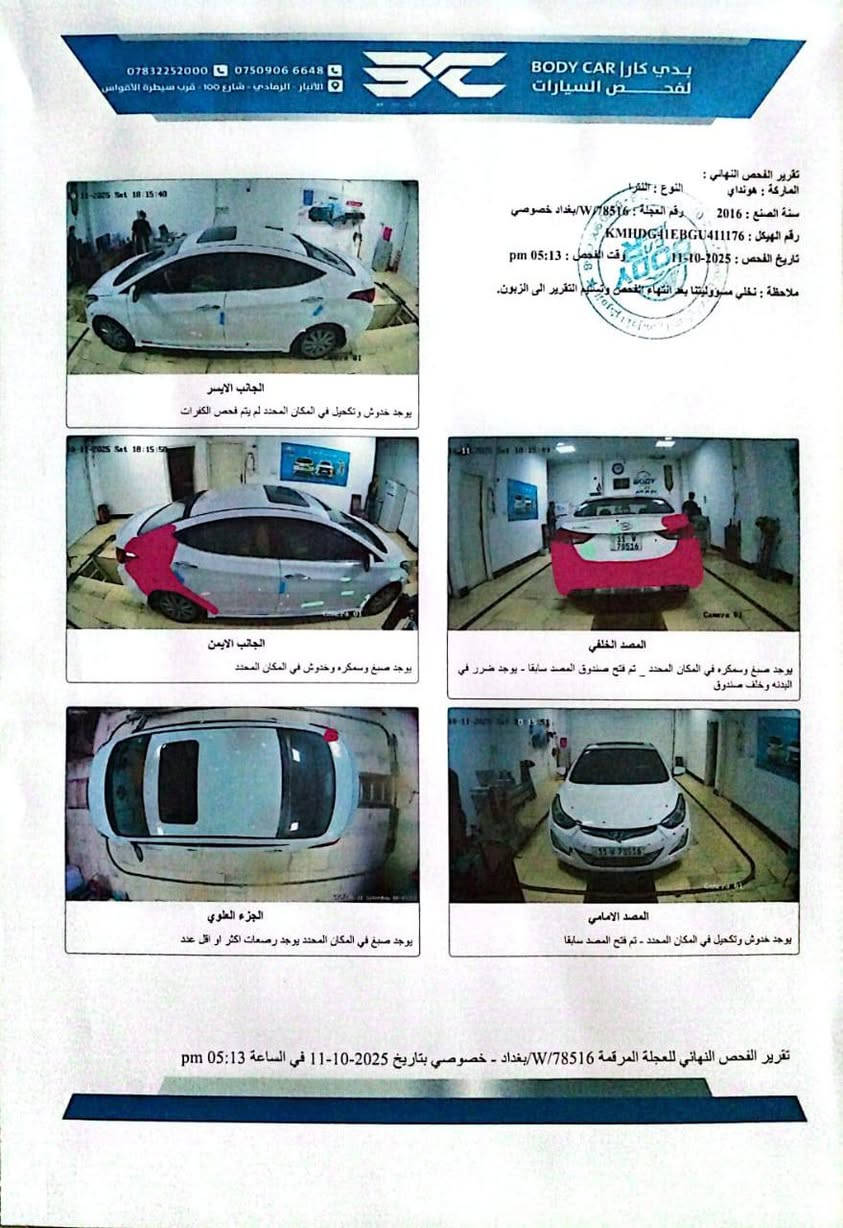 سلام عليكم الانتره 2016 سياره هاذا سوناره كدام عين و بيه تكشير بنيد و صندوق شويه اثر غسل سياره فول مواصفات منظومه زنون كامله  عده بصمه سعر سياره 130 وبيه مجال مكان سياره الانبار رمادي رقم تفاصيل ***********
