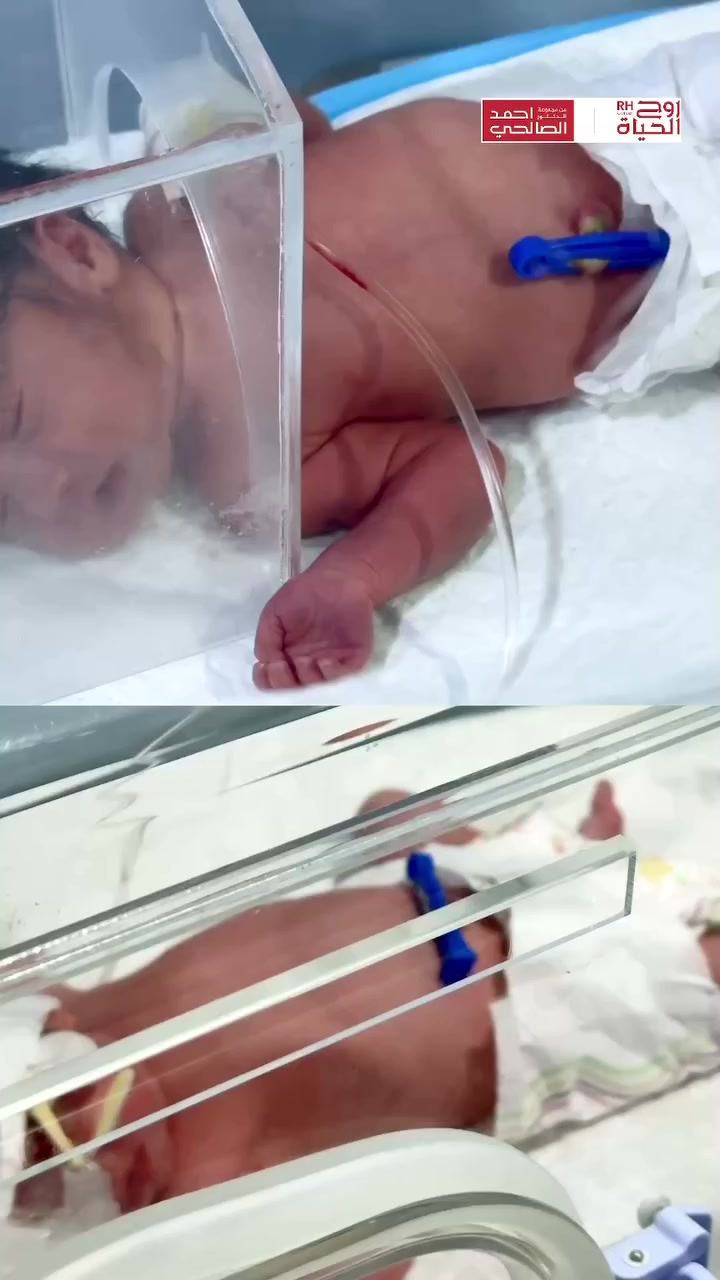 صغيرة السن… كبيرة الإنجاز!
بعد 5 سنوات من الزواج، وبفضل الله وتقدّم الطب، رزق مركز روح الحياة هذه العائلة بـ توأم البنات، الزوجة البالغة 18 عامًا المصابة بفرط نشاط الغدة الدرقية وتكيس المبايض الشديد، والزوج الذي يعاني من تشوهات في الحيامن، نجحوا عبر أطفال الأنابيب في مركزنا بتحقيق حلم الأبوة والأمومة.

ابدأوا رحلتكم نحو الأمومة والأبوة مع خبرائنا اليوم! احجزوا استشارتكم وامنحوا حلمكم فرصة التحقيق.

العنوان:
بغداد/ العطيفية - مقابل المحكمة الأتحادية 
الانبار/الرمادي - الشارع العام بداية شارع ميسلون مجمع برج المسك
الموصل/ حي المصارف - قرب جامع الشهيد مازن 
أربيل/ شارع 30 م - قرب القنصلية الايرانية 

للاستفسار والحجز تواصلوا على الأرقام التالية:
0780 151 4444 - 0772 151 4444
0772 449 4424 - 0750 219 2244
0785 756 6060
