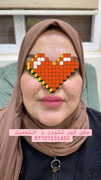تعتبر حقنة اوليديا واحدة من محفزات الكولاجين في البشرة، وتتكون بشكل رئ...