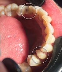 تركيبات زركون • ضمان ٢٠ سنة • المحمودية