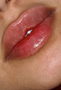 أسنان • مستلزمات شخصية