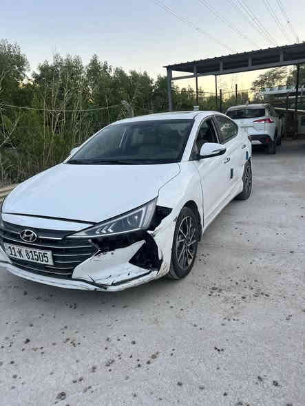 السلام عليكم الحلال راحلكم فدوه للبيع ؏ هذا وضعه الحادث مثل ما موضح بالصور سياره نضيفه وخير من الله النترا 2020 خليجي ماشيه 84 السعر 150 وبي مجال بسيط للأستفسار الاتصال ؏ الرقم *********** مكاني بغداد
