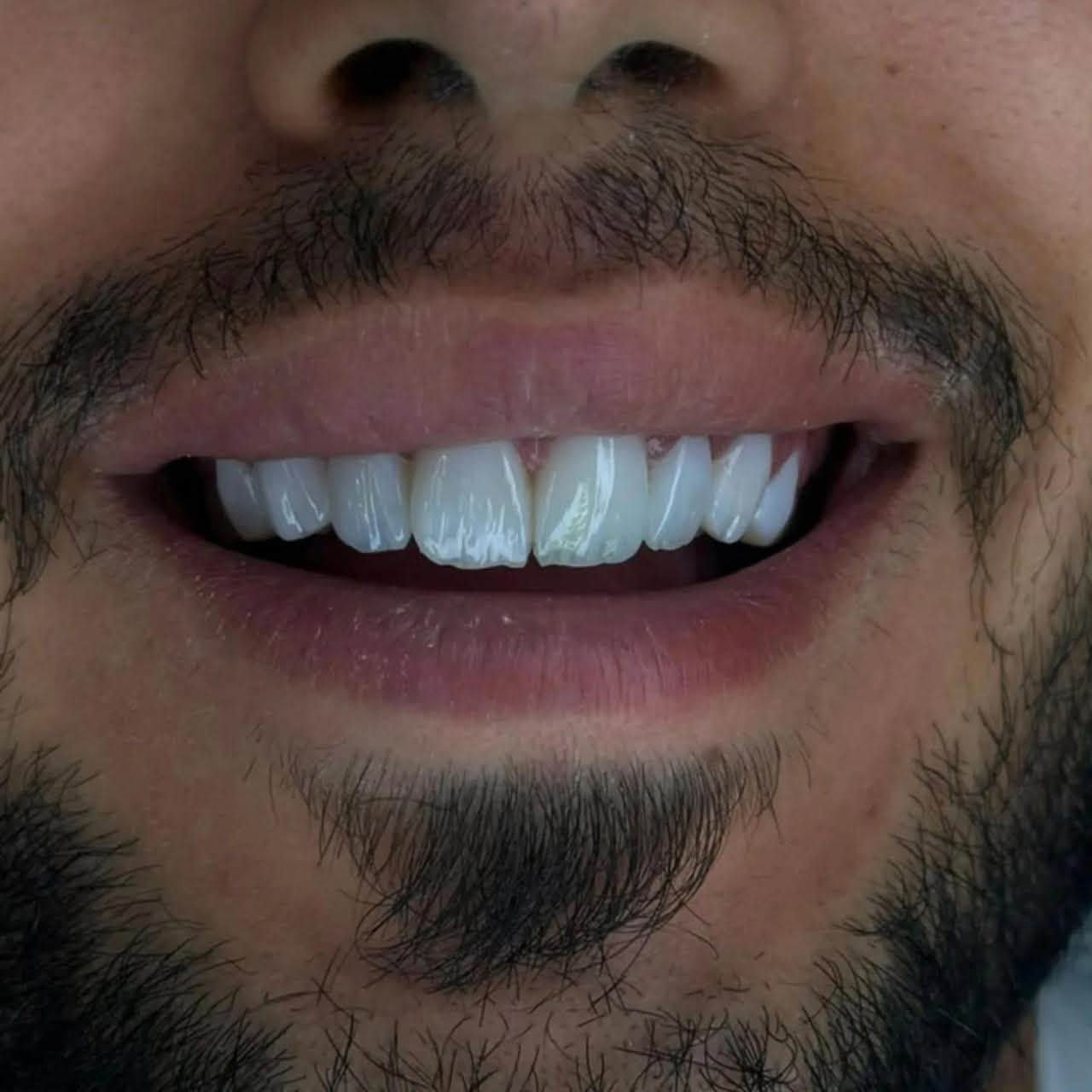 مركز ماسة الحسينية التخصصي لطب وجراحة الفم والأسنان 

متواجدين طيله ايام الأسبوع 
اهلا وسهلا ❤️

📍 الموقع: بغداد - الحسينية - خلف السوق الأول - شارع 20
📱 للاستفسار والحجز: ***********
