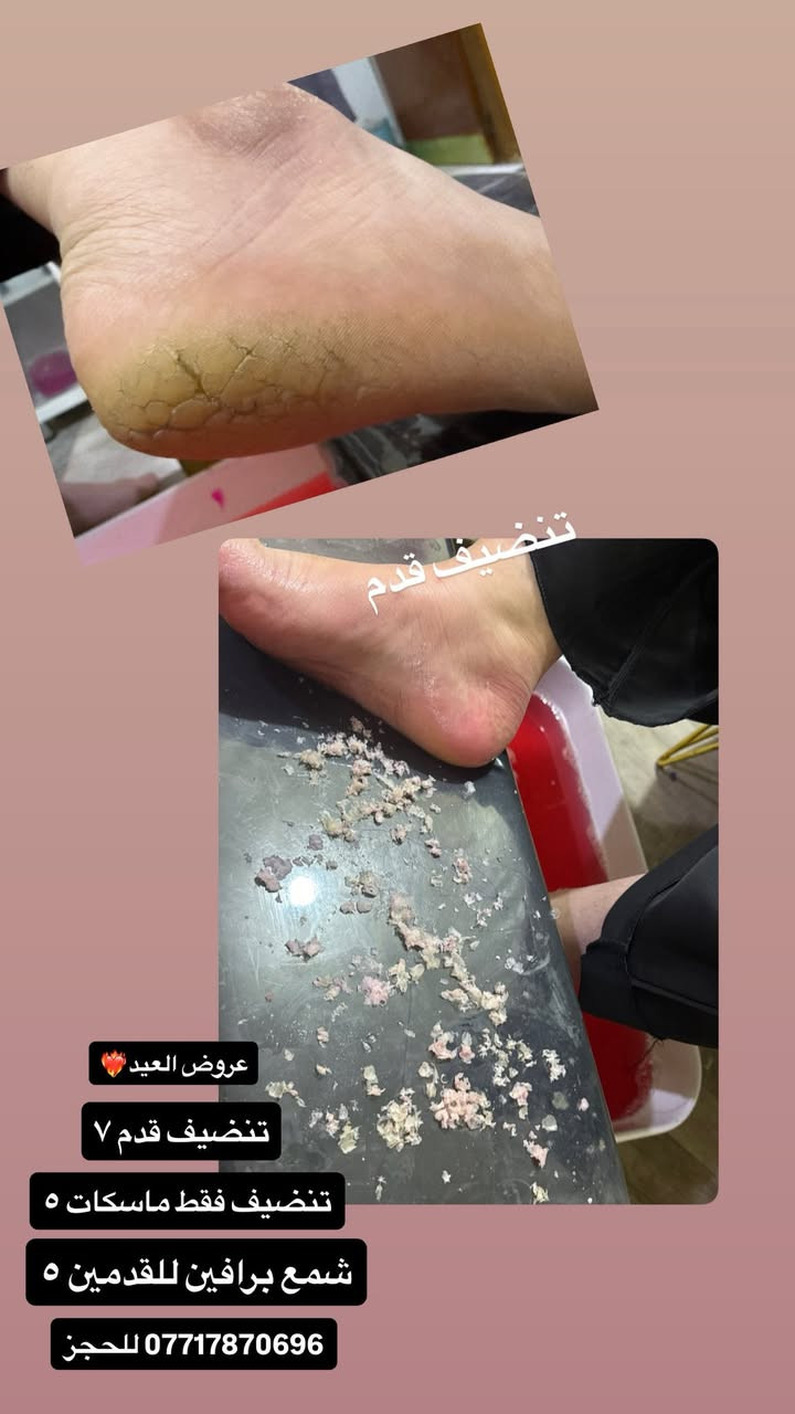 كوت الخاجيه شارع30 للحجز ***********
