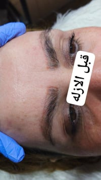 مسح تاتو • من اول جلسه • السماوه حي الحسين