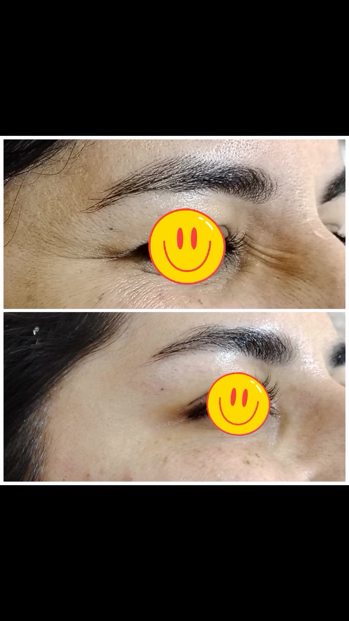 نتائج البوتكس الفرنسي اوتسيالي بعيادتنا

للحجز :***********

العنوان :بعقوبة-التحرير الفلكة الاخيرة مقابل مركز صحي التحرير الثاني مجاور مجمع الهيبة العائلي

#اجعل_ابتسامتك_افضل #مع_عيادة_الدكتورةميس
