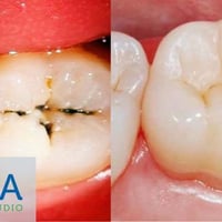 مجاناً • حشوة تجميلية • كربلاء حي الموظفين