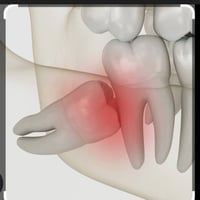 أنا طالب ماجستير في جراحة الفم  - كلية طب الأسنان       يقدم فرع جراحة...