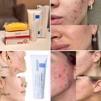 ✨ باكج تنظيف وتهدئة البشرة ✨  إذا تعانين من حبوب، دهون أو مسامات واسعة...