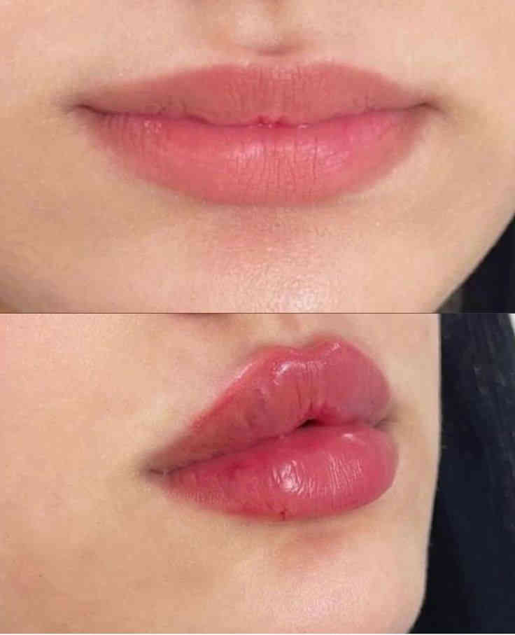 سوينه عروض 
✨تردين تسوين  تجميل ما عندج يمنه سعار مناسبا
عروض راس اسنه عروض جميلههه
*ابلازمه وجه 30💃🏻💃🏻
*ابلازمه وجه لتصبقات والكلف 40🔥🔥
*فلر شفه كوري ب30💋
*فلر شفه الفرنسي  ب35🔥💋
*فلر شفه باريسي ب50💋💃🏻
*فلر شفه اسويسري ب55💋🫂
*فلر وجنات  سيسي 35 (6جلسات)🙎🏻‍♀️
*نضاره الفائقه 45*
*ابرة العنبر الزعفرانيه ب40

*بوتوكس لرفع الحاجب  ب50🤎
*بوتوكس شد كصه ب50💆🏻‍♀️
*بوتوكس لتوسيع العين ب50🫣
*بوتوكس لشد التجاعيد 110🫢
*غمازه 25🔥🔥🔥
*تبييض البشرة ب70 ألف 💋💃🏻
*ابرة نضارة وتوريد وترطيب ب100الف 🔥🔥🔥
*علاج الگلف العميق 60 ألف 
*تعديل الأنف بل فلر ب45
*علاج داء الوردية ب30 ألف🔥🔥🔥🔥
*تغيرر شامل فلر فرنسي ايطالي 300
العنوان//كربلاء 
الستفسار /***********
