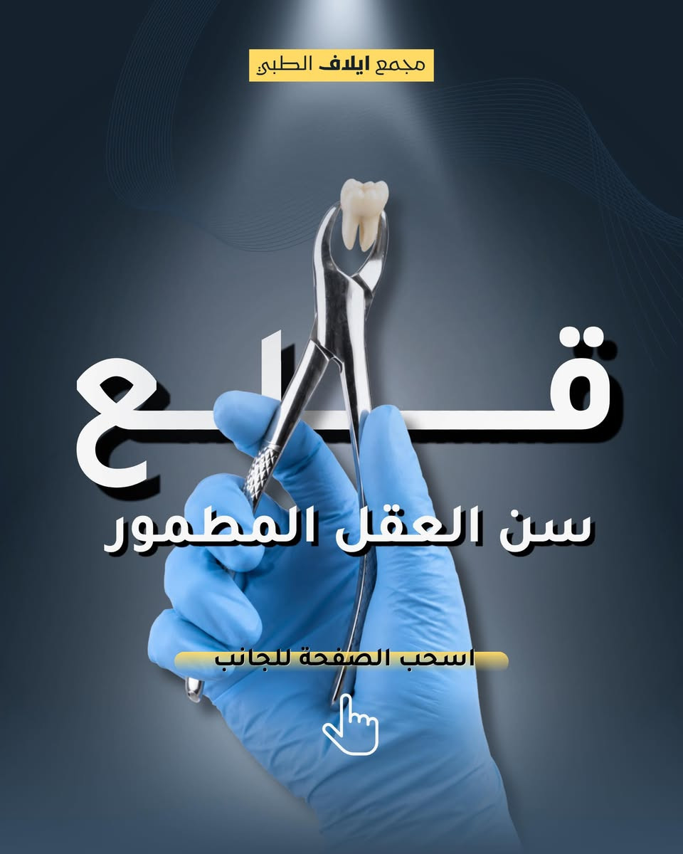 السن المطمور قد يتسبب في الضغط على الجذور المجاورة، أو يؤدي إلى حدوث التهابات متكررة في اللثة وصعوبة في التنظيف. 
لذلك، فإن إزالته في الوقت المناسب تقيك من مضاعفات آلام الفك والصداع المزمن.

نقدم لكم في قسم طب وجراحة الأسنان بمجمع إيلاف الطبي حلولاً جراحية دقيقة وآمنة لقلع وتدبير السن المطمور بأيدي أطباء اختصاصيين، مع توفير رعاية متكاملة تضمن راحتكم وسلامتكم.

📞 للتواصل والاستفسار، اتصلوا بنا:
*********** – ***********
📍 العنوان: خانقين - شارع البريد - قرب مول التفاح الأخضر.
🌟 لأن صحتك تستحق الأفضل.
#مجمع_إيلاف_الطبي #قلع_الأسنان #سن_العقل
