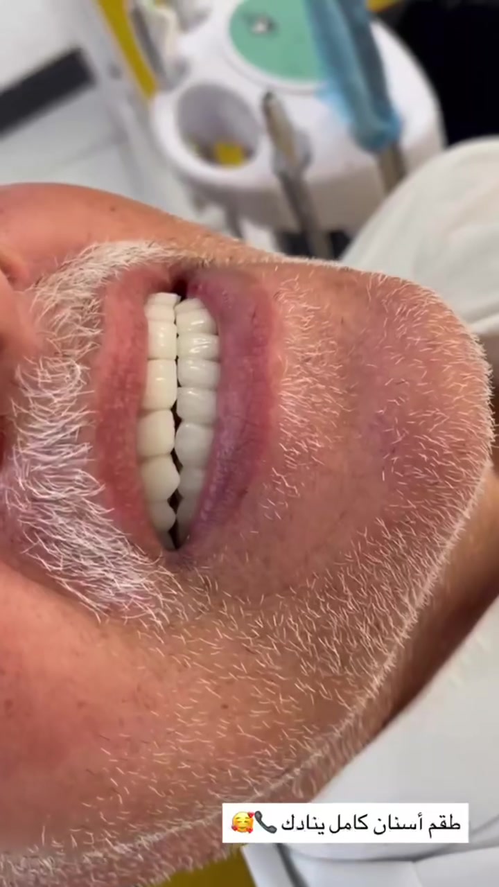 تغليف الأسنان ليس تجميلاً فقط، بل هو استعادة لشكل السن وقوته ووظيفته الطبيعية ✨

متواجدين لخدمتكم طيلة أيام الأسبوع #مراكز_الشركة_الطبية_العالمية #صحة_الأسنان 

🔻
🏢 العنوان / بغداد _ الزعفرانية  الاربع شوارع _ مجاور مدرسة الاميرات ..
📲 للحجز والاستفسار 
***********
#مركز_سما_الزعفرانية_لطب_وتجميل_الاسنان
