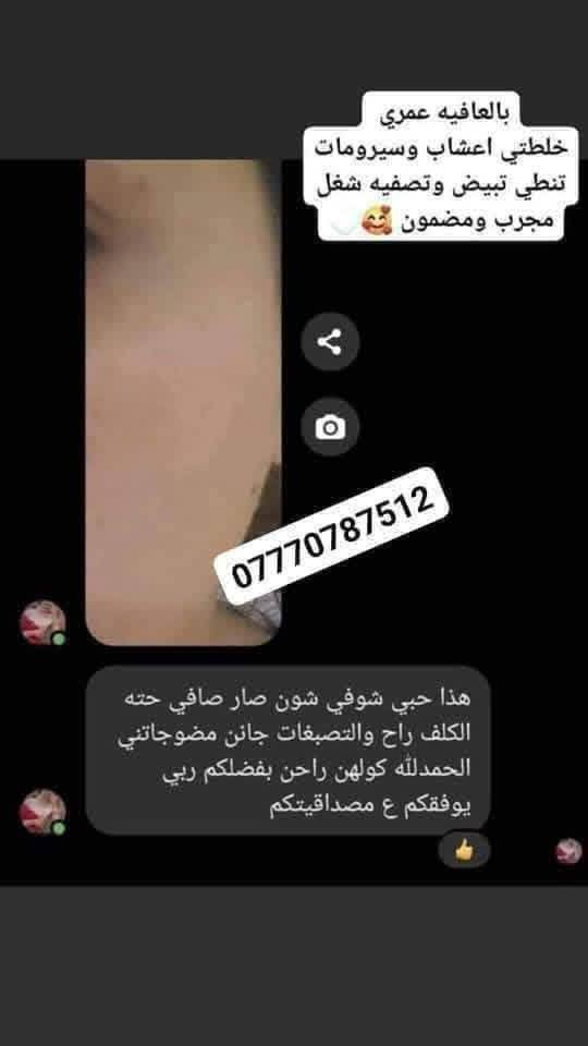 الف رحمه على روح امه وابوه اليعلقلي هذا مصدر رزقي الوحيد #يارزاق 🤲❤️
خلطة بشرة تجنن تسوي الوجه گيمر 
طبعا تستخدم للرجال ونساء 

#خلطه عباره عن سيرومات مابيه اي مضره  شغلها يخبل  وفوائده تجنن على بشره 
تعالج مشاكل البشره #تصبغات_اسمرار_كلف_حبوب_نمش يعني هي تساعد البشره تعيد حيويته تنطيه نضاره حلوه

للحجز مراسله الخاص
او واتساب ***********
