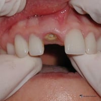 جامعة واسط • تنظيف أسنان • جراحة الفم