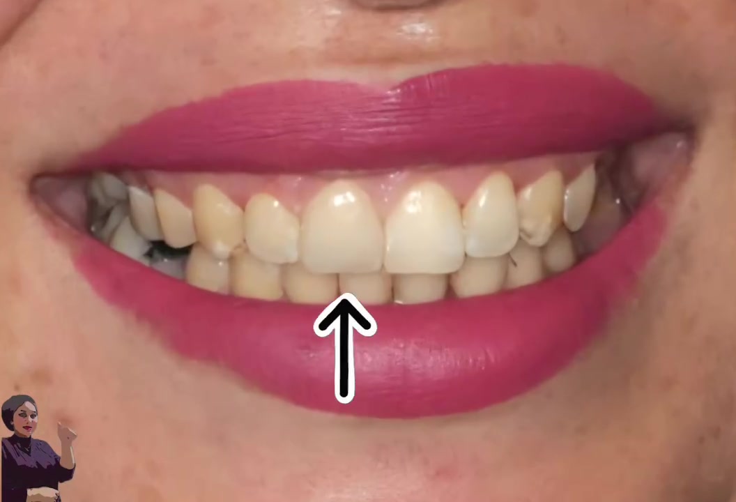 👈تجميل الاسنان بيد دكتورة فرح💯 اختصاص تجميل الاسنان وخبرة ١٤ سنه بالعمل المستمر 🤩🤩
بعقوبة- مدخل شفته الرئيسي
*********** للحجز ☎️
