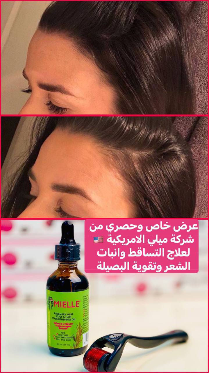 🎀عرض خاص🎀
افضل عرض لتكثيف وتطويل ومنع تساقط الشعر يتكون 👈 زيت اكليل الجبل والنعناع للشعر من براند ميلي الامريكي🇺🇸 + ديرمارول💖
 
✅ سيروم زيت إكليل الجبل الاصلي من شركة MIELLE
✨زيت ميلي لتقوية الشعر والفروة
✨مناسب لجميع انواع الشعر
✨مناسب للشعر المصبوغ
     يحتوي على اكليل الجبل والنعناع
✨يساعد على نمو الشعر وكثافته
✨يقوّي الفروة و الشعر
✨يستخدم لعلاج الفروة
✨يستخدم لعلاج الاطراف
✨يعطي الشعر مظهر صحي ولمعة

💖ديرما رول ✨
💖للوجه والشعر والجسم
💖تحفيز نمو الشعر وتساعد في انبات البصيلات
💖تحفيز نمو اللحية
💖تكثيف الشعر وتقوية الدورة الدموية في فروة الرأس
💖تعزيز تدفق الدم في فروة الرأس
💖كما يعمل على تحفيز إعادة نمو الشعر والتقليل من تساقطه
💖يحفز إنتاج الهرمونات التي تساعد على تقوية بصيلات الشعر وانتاج بصيلات شعر جديد
المنشأ امريكي🇺🇸💯 
سعر العرض 15 الاف  
🚘 يوجد خدمة توصيل لجميع محافظات ٤ الاف 🚘


**إذا كنت صاحب هذا الإعلان وتريد حذفه لأي سبب، رجاءا أرسل رسالة إلى الدعم الفني**