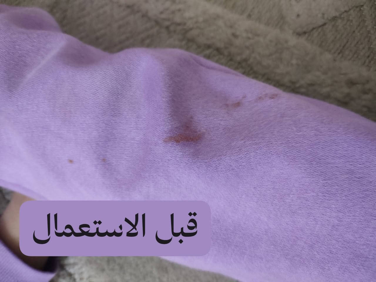 تعالو اسولفلكم سالفه القلم السحري
شموسه عالغده اليوم طكعت بجامتها بمركه باميه وتعرفون الباميه دهينه تصير صح صابونه متبقي طكعه بس كلت للسرعه اجرب القلم وجربته فعلا مبقت اي طكعه وميحسس الجسم يجنن
يفيدكم تخلو بالجنطه وين مترحون انقاذ جاهل وصخ ملابس وكع على ملابسكم شي
@إشارة


**إذا كنت صاحب هذا الإعلان وتريد حذفه لأي سبب، رجاءا أرسل رسالة إلى الدعم الفني**