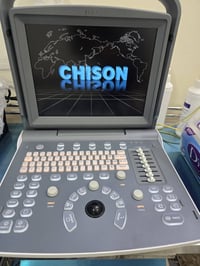 سونار ملون • ايكو ٢