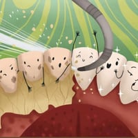 مجانا مجانًا 🛑 تنظيف الاسنان وازاله التكلسات والتصبغات     ♦️الوقاية م...