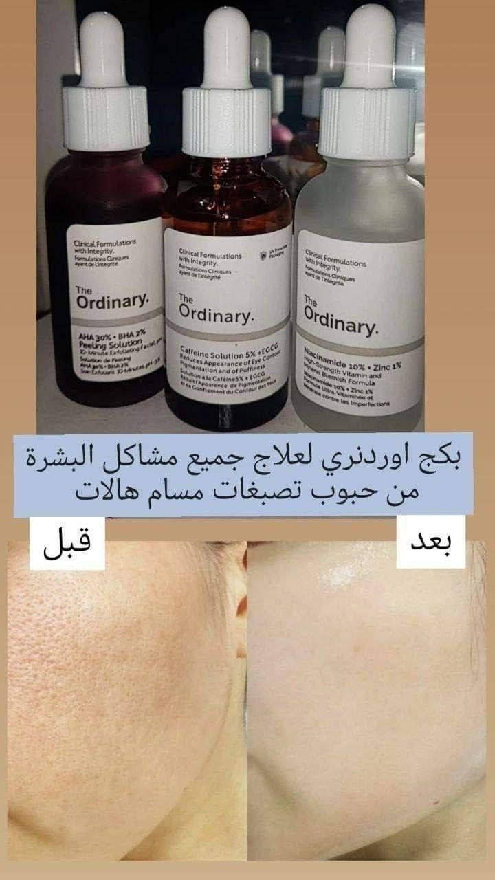 بكج  سيرومات اوردنري 
🔥 بكج اوردنري هو الاقوى للتصبغات 

يتكون من 3عبوات الأساسية: 💞

١-سيروم الكافيين لعلاج الهالات السوداء والتجاعيد وانتفاخ الجفن.
٢-سيروم التقشير بأحماض الفواكه لعلاج كافة مشاكل البشرة.
٣-سيروم نيسانميد لعلاج المسامات واثار الحبوب وشد البشره
السعر 20 الف 
تخفيضات بدل 35 الف بغداد, العراق


**إذا كنت صاحب هذا الإعلان وتريد حذفه لأي سبب، رجاءا أرسل رسالة إلى الدعم الفني**