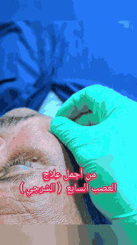 علاج العصب السابع • عامر العلي • السماوة باتا سوك