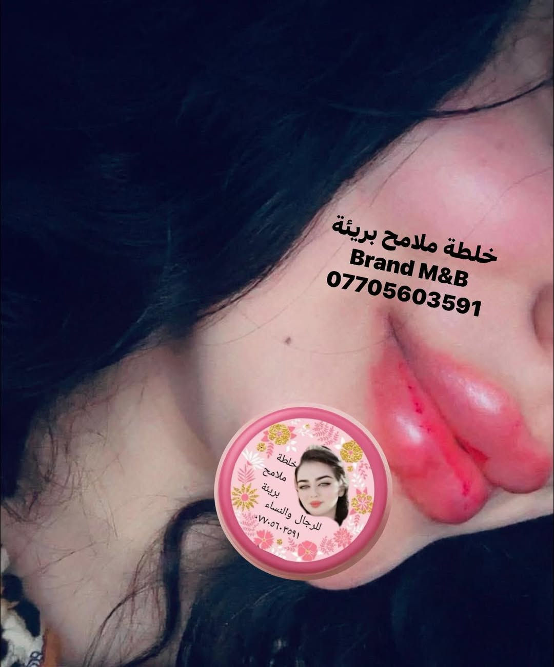 باقي اسبوع للعروض🚀
تنطيج بشرة قشطة 💕تبيض نضاره توريد شد ازاااالة __الحبوب وآثارها__والتصبغ وغيره 
براندي خلطة ملامح بريئة ✔️واكيد الضمان أسبوعين مابدا فرق ترجع او تستبدل اهم شي تصورين قبل وبعد وتراسلينا رقمي الخاص هذا ***********
