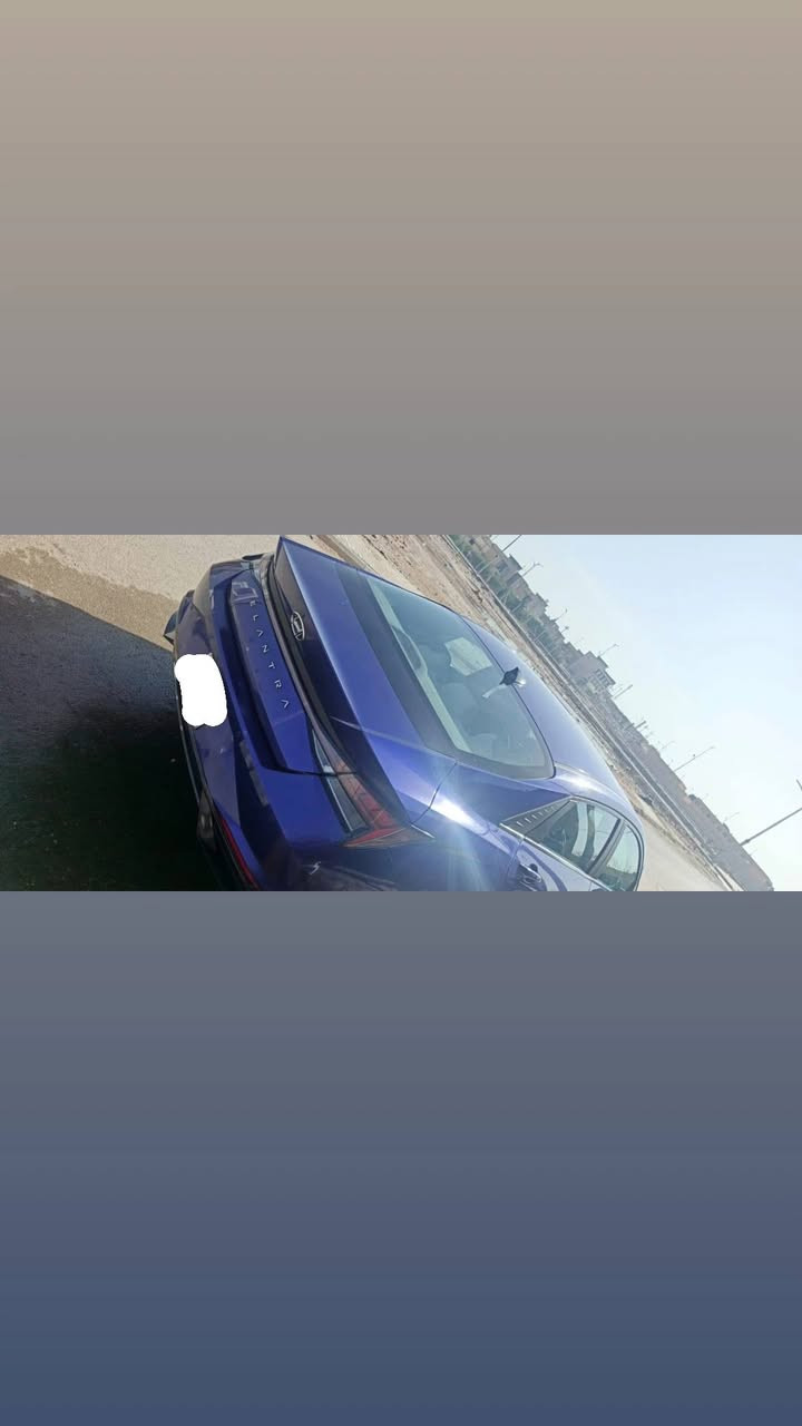 سلام عليكم النترا 22 استقطاع من الموظف بيها وكاله عامه من الموظف فول مواصفات للاخير ثلاث وضعيات قياده بصمه عدد 2 خليجي فقط الموضح بل صور لطخه الباقي مكفول ممشه ٨٠
سعر 147 رقم ***********
رقم بغداد
