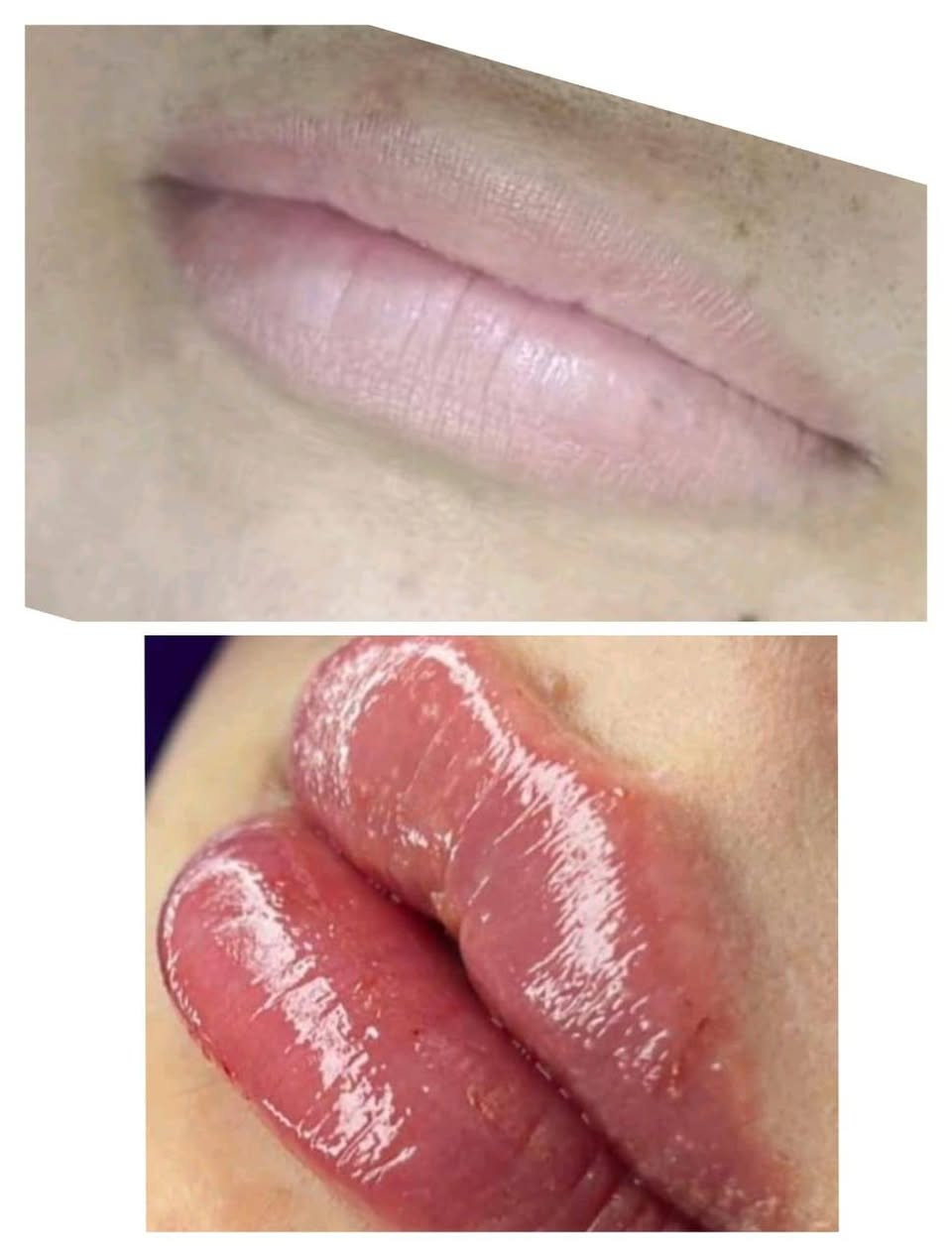 تعلن عيادات إبرو لطب الاسنان وتجميل عن عروض وتخفيضات في قسم الأسنان والتجميل مكانه  ماجديه نهاية شارع الجامع مقابيل مأكولات البيك ***********
