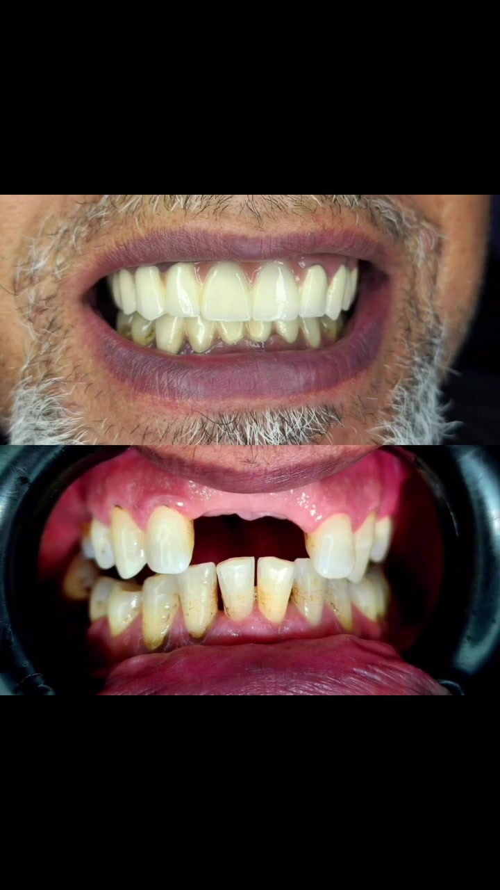 الشغل الصح✅بالمكان الصح ✅
❤️❤️❤️❤️❤️❤️❤️❤️❤️❤️

مجمع ترف كلينك الطبي.

العنوان مدينة الصدر خلف سوق العورة 
قطاع ٧١ مقابل ملعب قطاع ٣٦
للحجز والاستفسار مراسلة الصفحة أو الاتصال على الأرقام التالية ☎️ ‭٠٧٧٥ ٨٦٣ ٥٧٥٠‬

#مدينةالصدر
#اسنان
#تركيب
#حشوة
