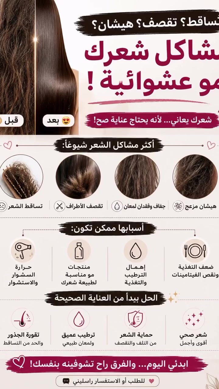 ✨ شعرك سر جمالك ✨
مع الشامبو والبلسم خلي النعومة واللمعان يحكون عنك 💆‍♀️🤍
تنظيف عميق + ترطيب قوي = شعر صحي وحرير من أول استخدام

جربيه وراح تلاحظين الفرق بنفسك 🔥✨
للطلب أو الاستفسار راسلينا 📩#بصره_بغداد_اربيل_جاري_الفولو_مي_اكسبلور #عناية_بالشعر #منتجات #العراق #ترند


**إذا كنت صاحب هذا الإعلان وتريد حذفه لأي سبب، رجاءا أرسل رسالة إلى الدعم الفني**