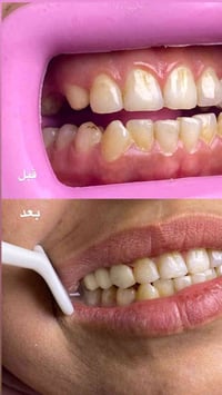 دكتورة_أسنان • طوز_حي_العسكري • فيلر_بوتوكس