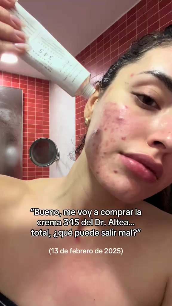 كريم 345 من دكتور الثيا الاكثر شهرة حالياً😍😍🔝 

يعتبر كريم اصلاح مكثف ويوفر عناية متكاملة للوجه ⬇️⬇️⬇️ 
• يقلل المسام 
• يساعد في اخفاء آثار الحبوب بشكل نهائي 
• يقظي على التصبغات العنيدة
• يرمم حاجز البشرة 
• يخفف تهيج البشرة ويهدئها 
• يعطي نضارة قوية للبشرة 
• يرطب البشرة بعمق 
• مناسب لجميع انواع البشرة حتى الحساسة 
• ذو قوام خفيف غير لزج وغير دهني يترك البشرة مع ملمس حريري ينعش البشرة طوال اليوم


**إذا كنت صاحب هذا الإعلان وتريد حذفه لأي سبب، رجاءا أرسل رسالة إلى الدعم الفني**