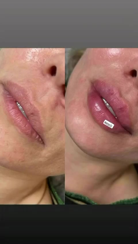 فلر شفه ,1cc
كوري سعره 70الف


**إذا كنت صاحب هذا الإعلان وتريد حذفه لأي سبب، رجاءا أرسل رسالة إلى الدعم الفني**