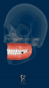 تعويض الأسنان • صحة الفم • البصرة المطيحه