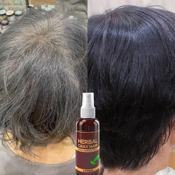 عرض الجمال ودلال يمنه وبس بمناسبة شهر مضان الفضيل سويت الكم عرض علئ التوصيل اطلب قطعة توصيل 4 الف
اطلب 3 قطع توصيل 3 الف  اطلب 5 قطع توصيل الفين 
سارعو واستغلو العرض لمدة يومين فقط
🔥🔥🔥🔥🔥🔥🔥🔥🔥
بخاخ HERBAL GRAY HAIR VERSE ESSENCE SPRAY (بخاخ خلاصة الشعر العشبي للشعر الرمادي). 
يغذي الشعر وفروة الرأس بعمق.لاستعاده اللون الطبيعي 
يعزز إنتاج الميلانين.. .
مصنوع من مكونات عشبية طبيعية وآمنة.
يساعد في إصلاح بصيلات الشعر التالفة ويترك الشعر ناعمًا ولامعًا.

#يوجد_توصيل_لكافه_المحافظات


**إذا كنت صاحب هذا الإعلان وتريد حذفه لأي سبب، رجاءا أرسل رسالة إلى الدعم الفني**