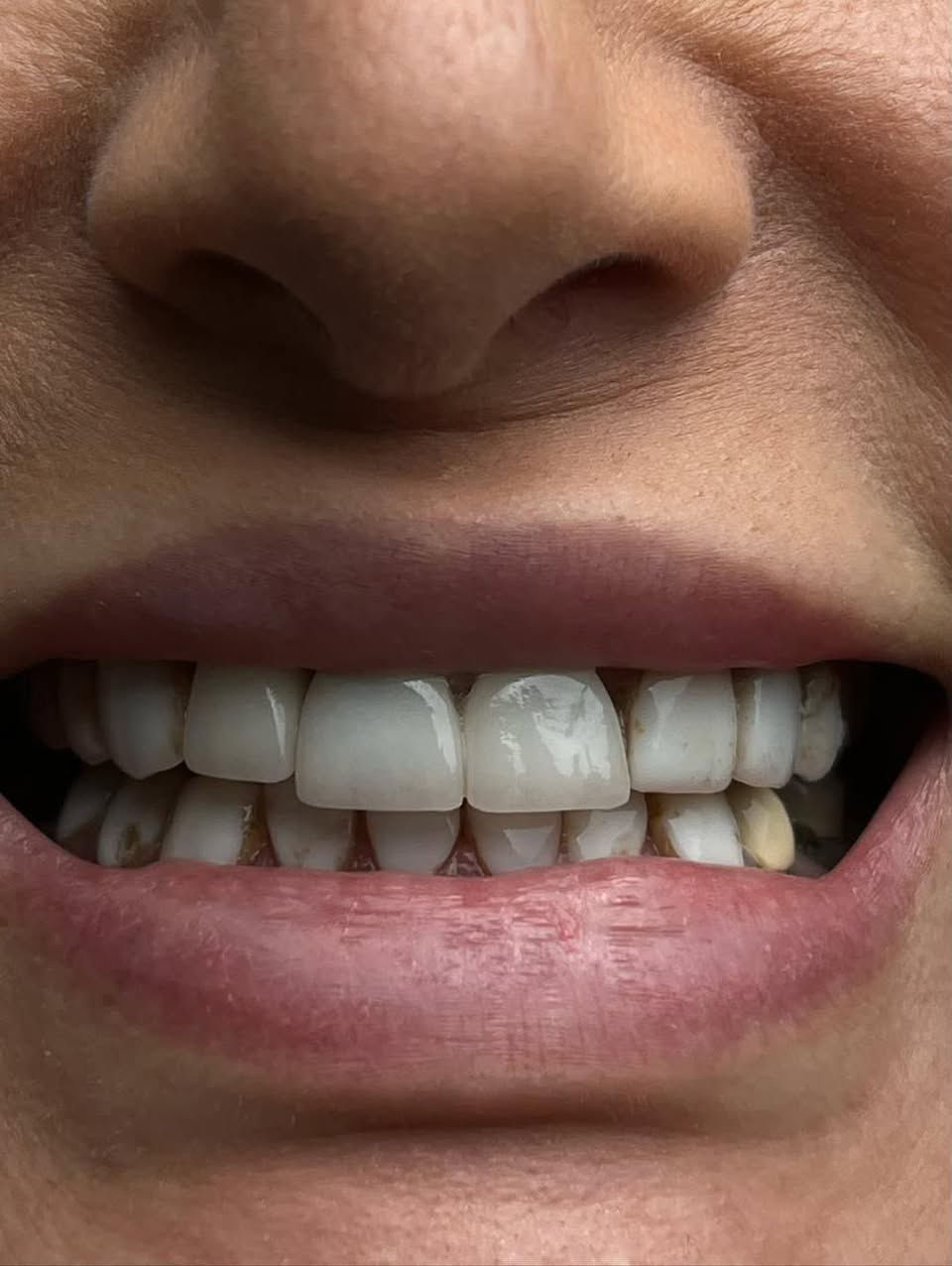 ”
* “تفاصيل بسيطة تصنع الجمال 🤍”
* “بسمة من القلب تكفي ✨”
* “أحلى شي لما تكون الابتسامة هي اللوك 🤍”
* “ثقة… وبسمة ما تنخبّى ✨”
* “ابتسامة بيها حكاية 🤍”
* “ضحكتي هي أجمل إكسسوار 😌✨ 
العنوان البصره قضاء الفاو - سوق الفاو الجديد - مجمع الجهاد الطبي الطابق الثاني - فوق عياده د عادل عطيه .
الرقم / ***********
