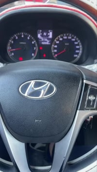 #دقة التشخيص اساس العمل  سياره اكسنت صاحب السياره رايد يبدل ماطور ستير...