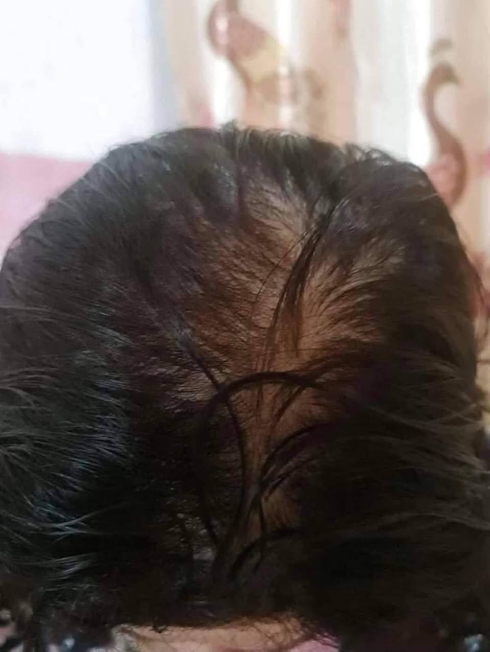 خلال سبوعين سبوعين لااكثر إذا مصار شعرج هيج أن بلخدمه
يطول شعر بشكل فضيع 😍✌️🏻

يمنعلج التساقط 

يكثف شعرج 

وينعمه ويلمعه شتريدين بعد أكثر سندوسه😉💜

يصير شعرج بطولج بالله العظيم 😍✌️🏻   دخذي واحد والثاني كد ماراح يعجبج الزيت غصب عليج راح ترجعين وتشترينه مني 🙊🥺😍وتوصيل لجميع محفظات 🚗🔥 بقيه البيجات عزلوا احسسلكم👍🏻❌

تعاي خاص ومعليج بل باقي توصيل جميع لمحفظات موجود لحجز ع خاص امنت الله ورسوله زيت مجرب وجربت ع شعري ومشالله نصحكم بيه كلش تاخذي تدعلي شرط ولله علفرق يشهدلله يجننن يجننن


**إذا كنت صاحب هذا الإعلان وتريد حذفه لأي سبب، رجاءا أرسل رسالة إلى الدعم الفني**